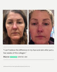 My Way Up Collagen Restore