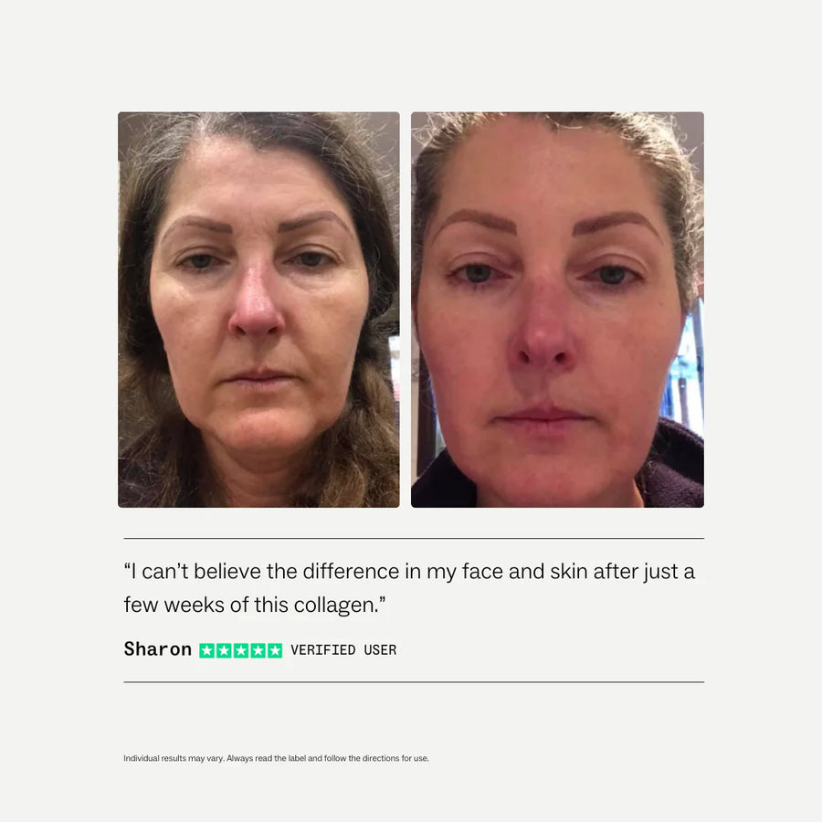 My Way Up Collagen Restore