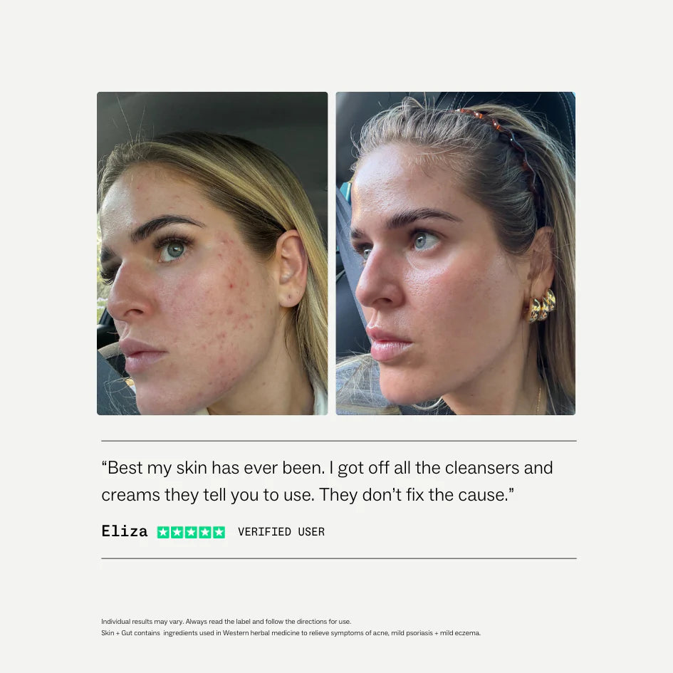 My Way Up Skin + Gut™