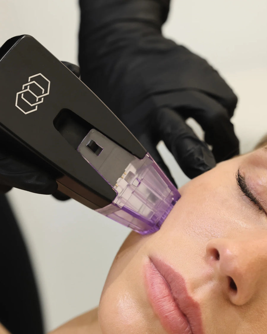 Morpheus8 RF Microneedling in Perth | BLANC Skin